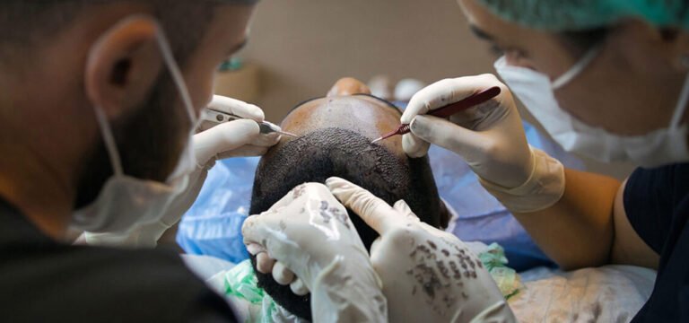Hair Transplants: A Comprehensive Guide for Cancer Survivors
