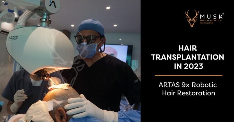 Hair Transplantation in 2023: ARTAS 9x Robotic Hair Restoration