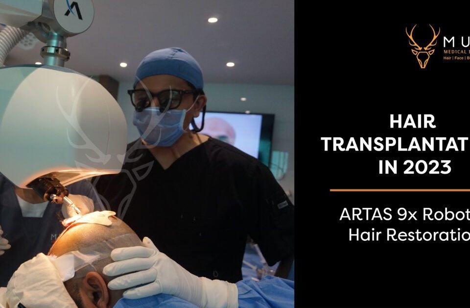 Hair Transplantation in 2023: ARTAS 9x Robotic Hair Restoration