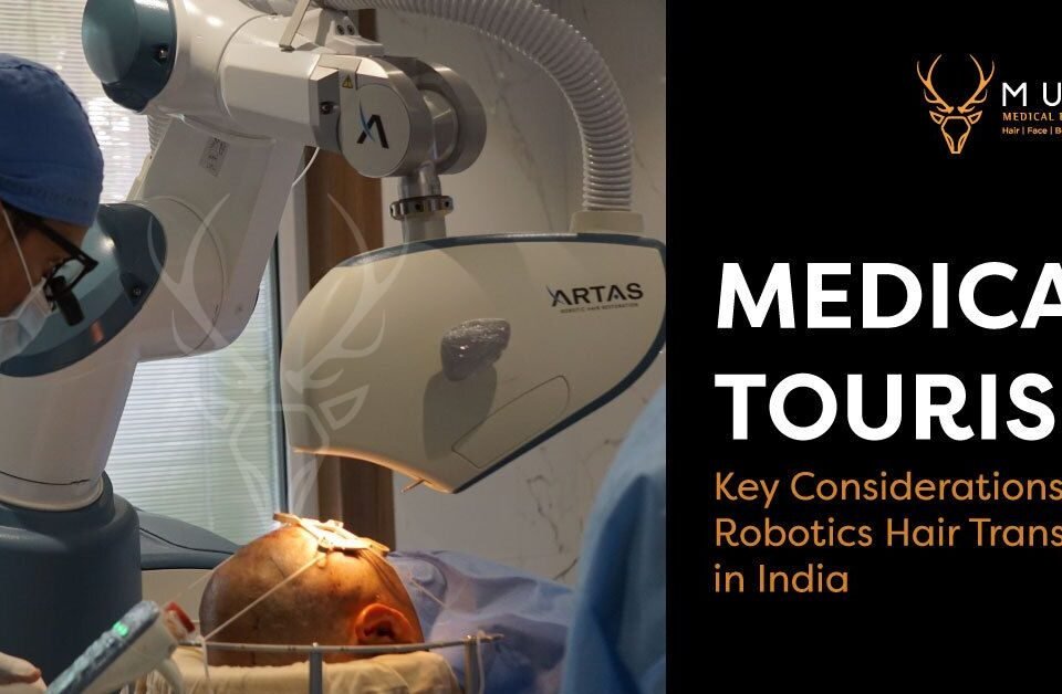 Medical Tourism: Key Considerations for Robotics Hair Transplant in India