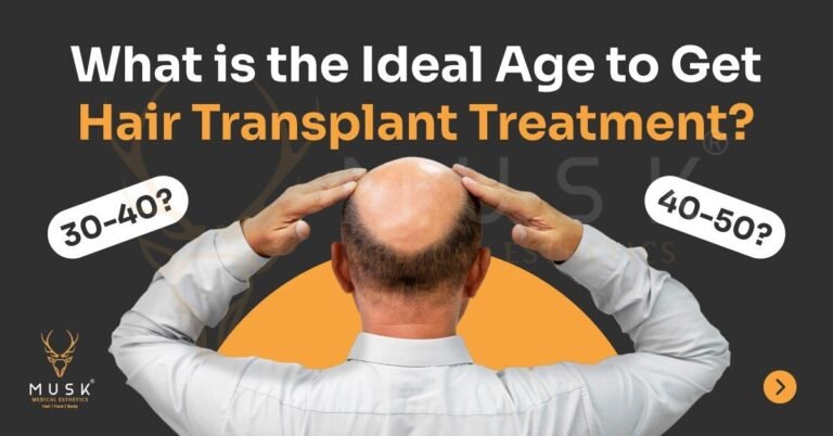 What-is-the-Ideal-Age-to-Get-Hair-Transplant-Treatment-1