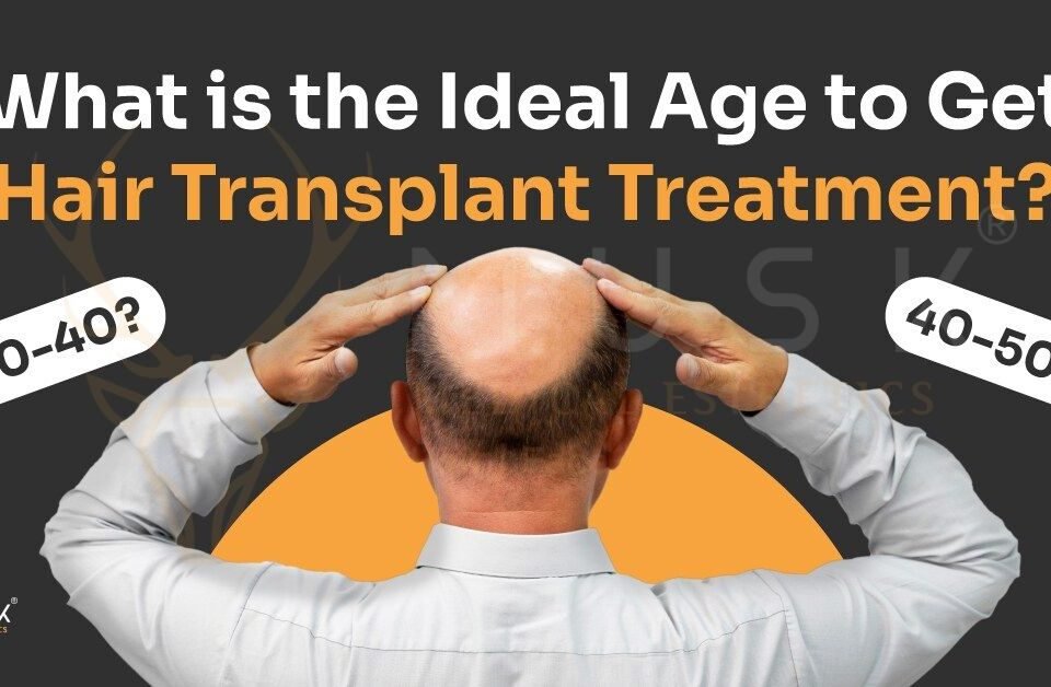 What-is-the-Ideal-Age-to-Get-Hair-Transplant-Treatment-1