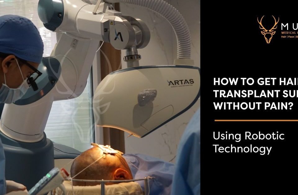 How to get Hair Transplant Surgery without Pain Using Robotic Technology?