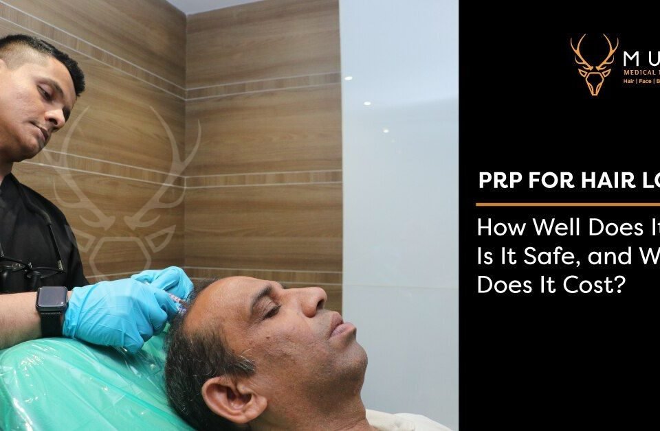 PRP-for-Hair-Loss-How-Well-Does-It-Work-Is-It-Safe-and-What-Does-It-Cost-3