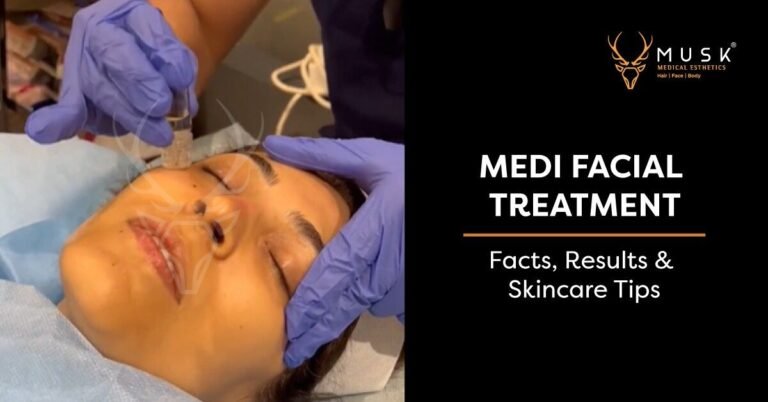 Medi Facial Treatment – Facts, Results & Skincare Tips