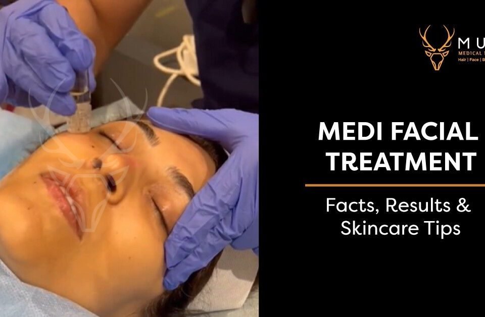 Medi Facial Treatment – Facts, Results & Skincare Tips