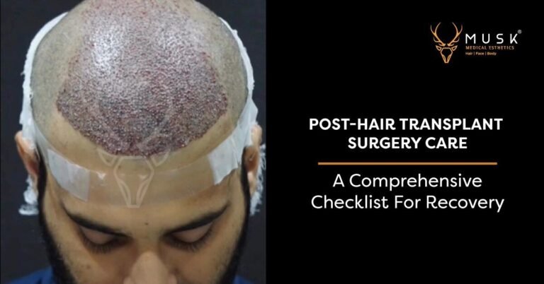 Post-Hair Transplant Surgery Care: A Comprehensive Checklist for Recovery