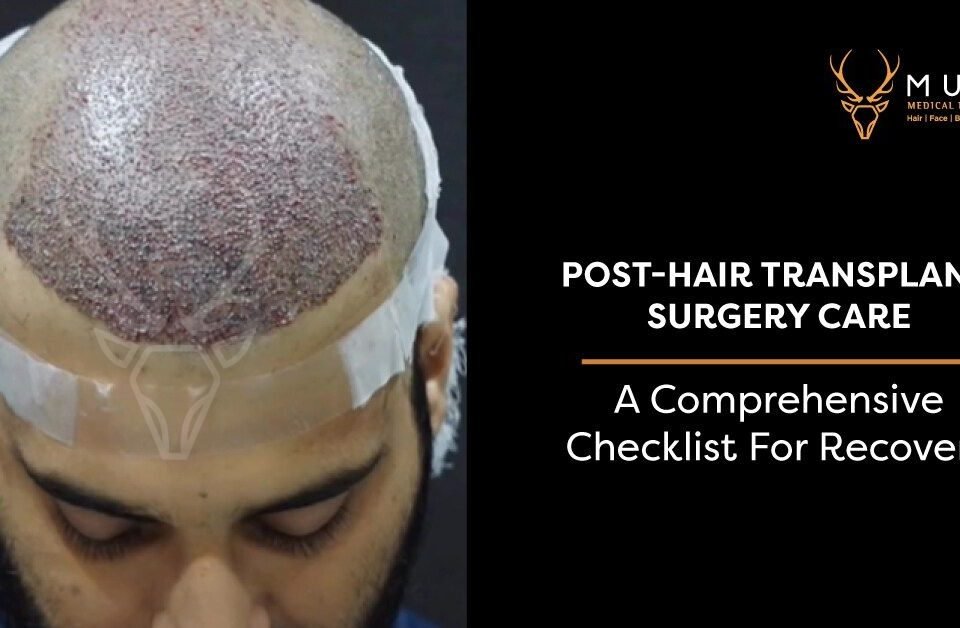 Post-Hair Transplant Surgery Care: A Comprehensive Checklist for Recovery