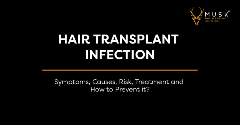 Hair-Transplant-Infection-Symptoms-Causes-Risk-Treatment-and-How-to-Prevent-it