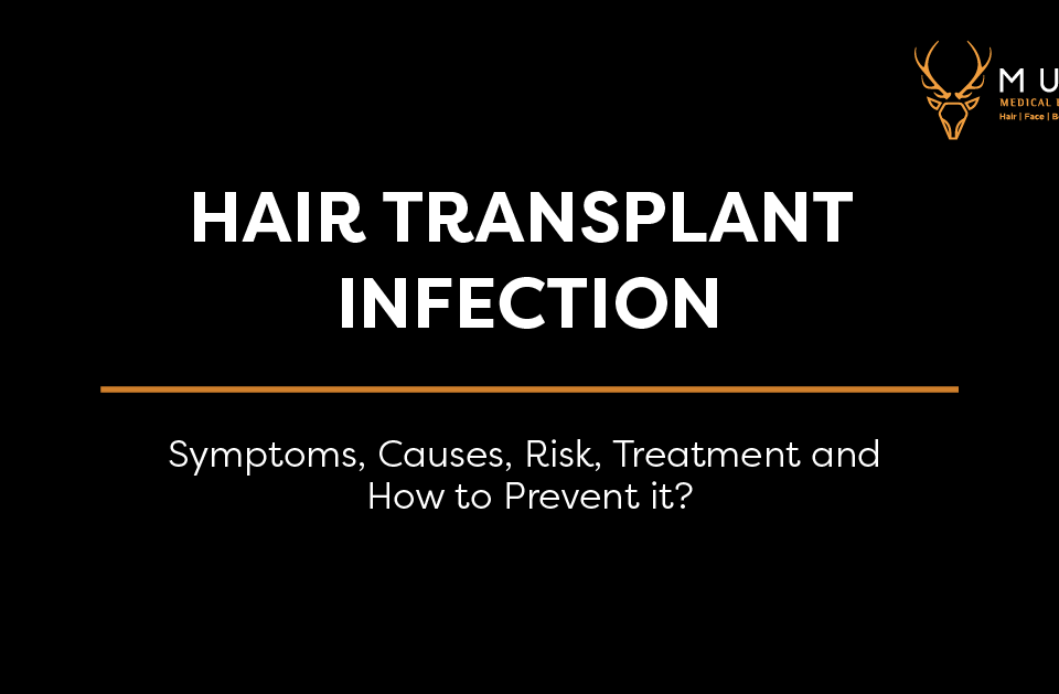 Hair-Transplant-Infection-Symptoms-Causes-Risk-Treatment-and-How-to-Prevent-it