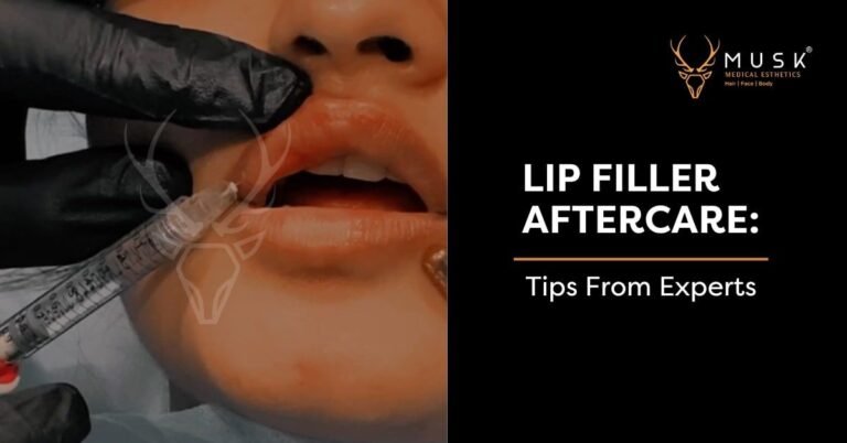 Lip-Filler-Aftercare-Tips-from-Experts-2