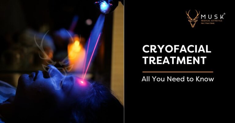 Cryofacial-Treatment-in-Ahmedabad-at-Musk-Clinic-All-You-Need-to-Know-1
