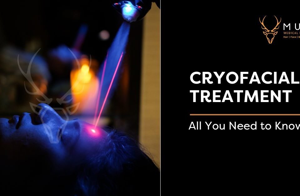Cryofacial-Treatment-in-Ahmedabad-at-Musk-Clinic-All-You-Need-to-Know-1