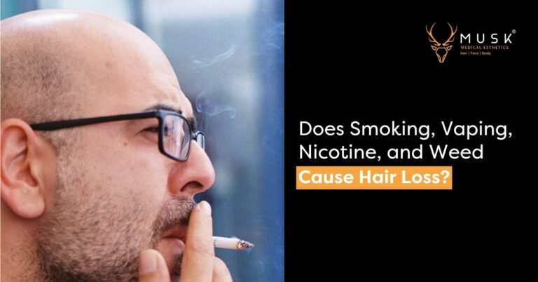 Does Smoking, Vaping, Nicotine, and Weed Cause Hair Loss?