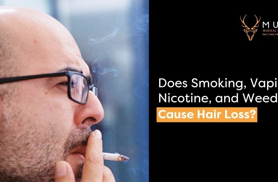 Does Smoking, Vaping, Nicotine, and Weed Cause Hair Loss?