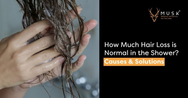 How Much Hair Loss is Normal in the Shower? Causes & Solutions
