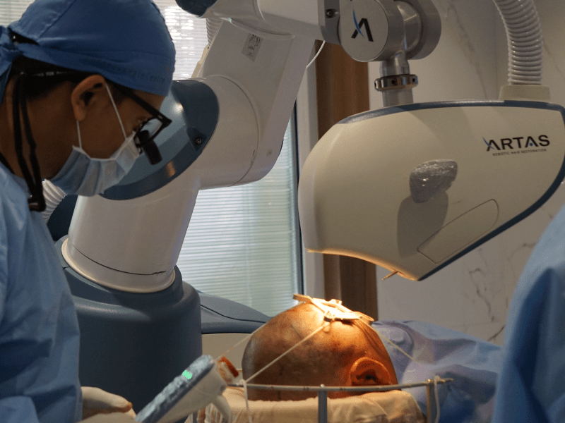 ARTAS-9x-Robotic-Hair-Transplant-in-Ahmedabad,-India-min
