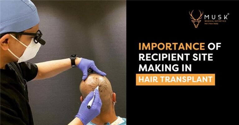 Importance of Recipient Site Making in Hair Transplant