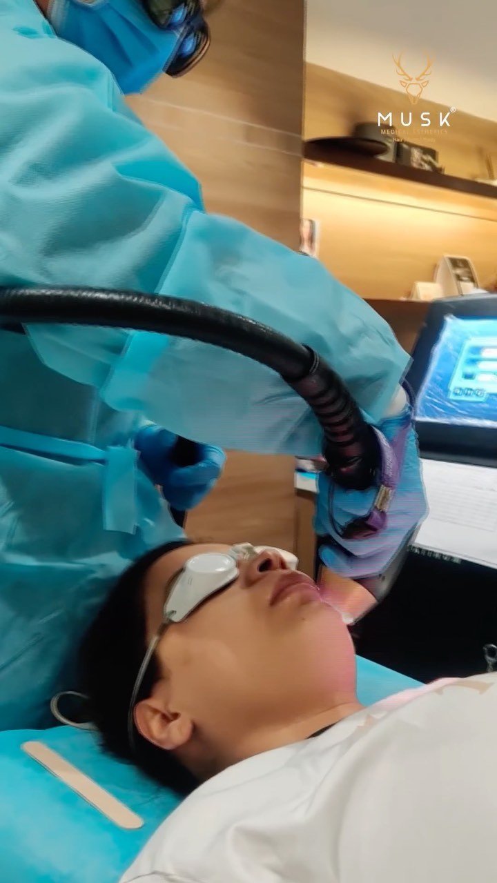 Laser-Hair-Removal