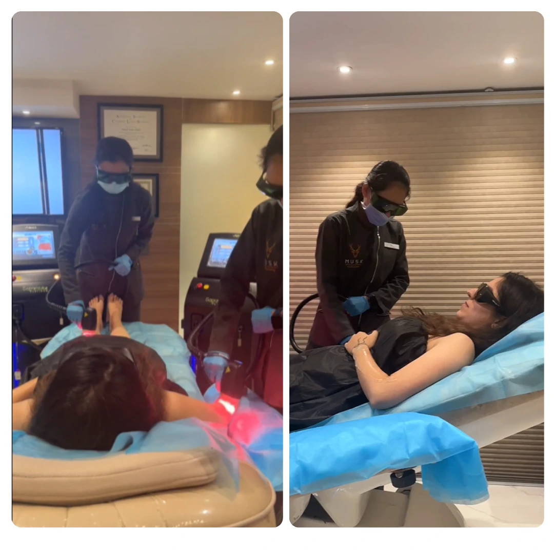 laser hair removal in Ahmedabad