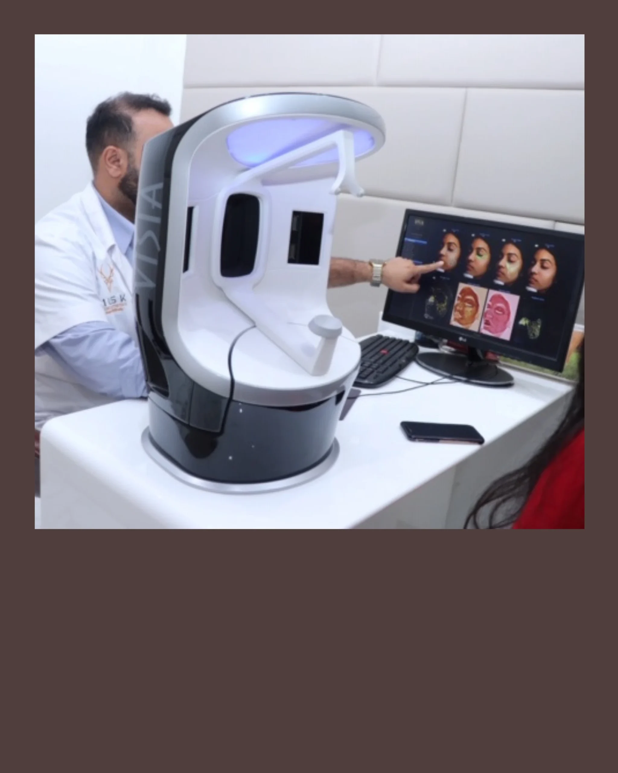 Visia Face Scan