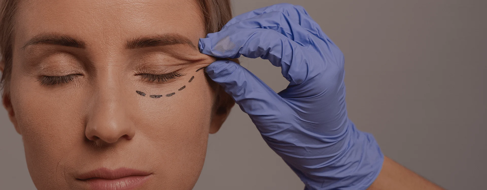 Blepharoplasty, India