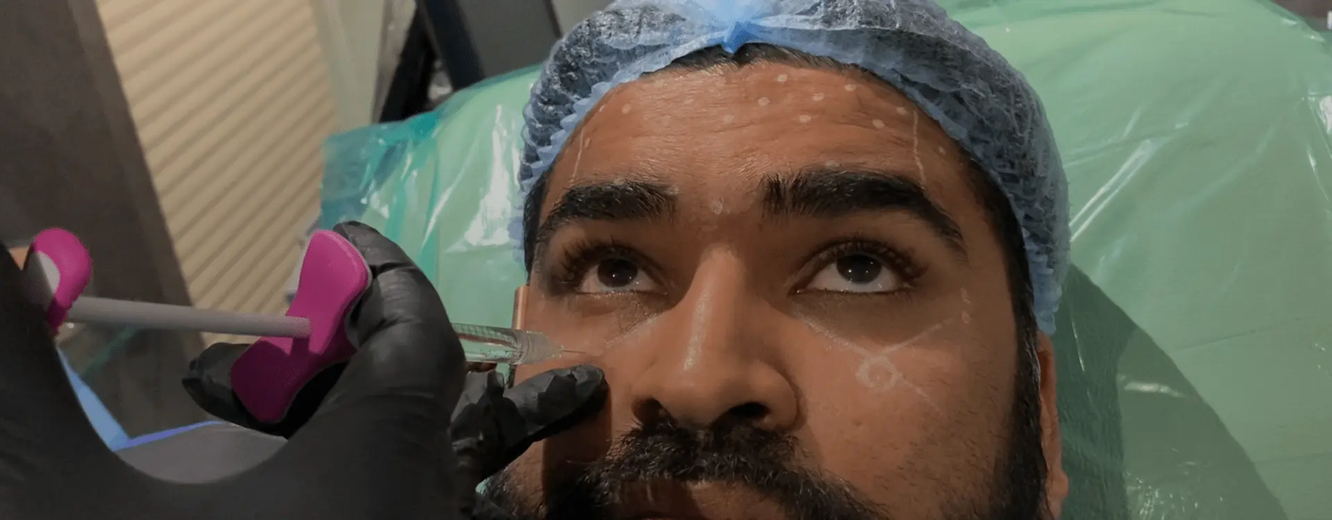 Botox Treatment, Ahmedabad, India