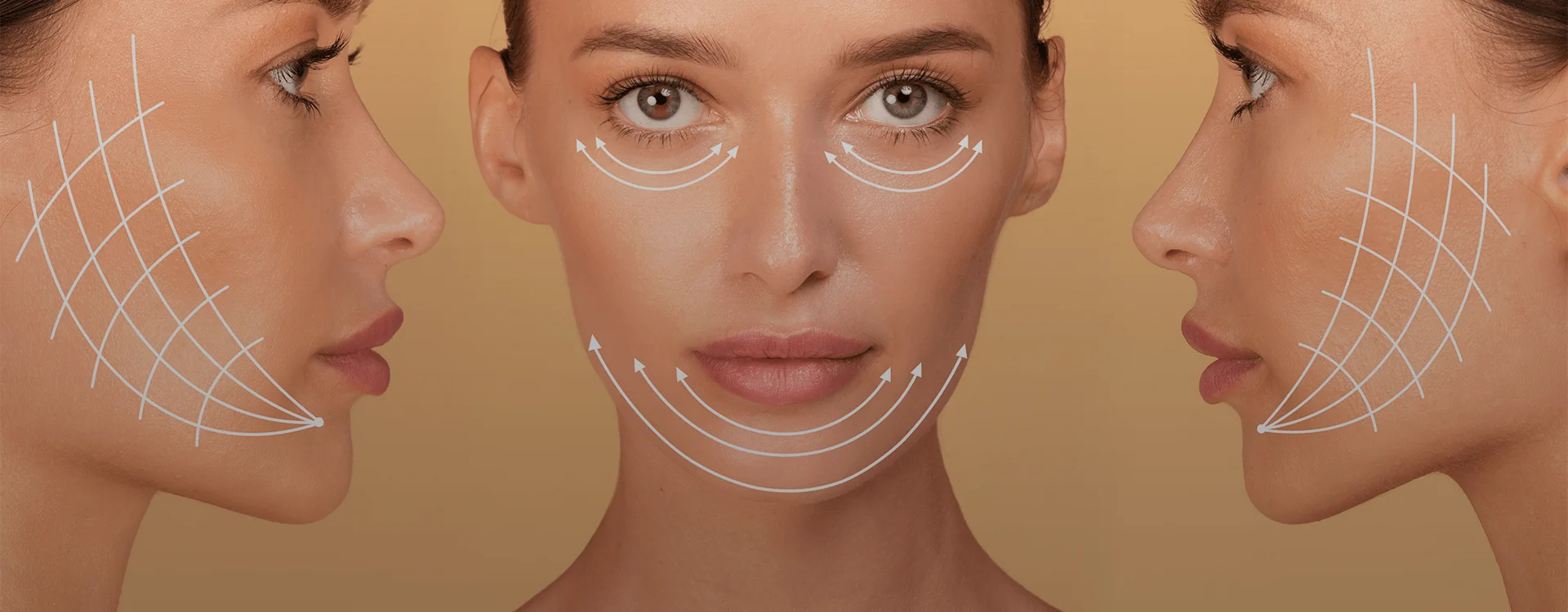 Comprehensive Facelift, India