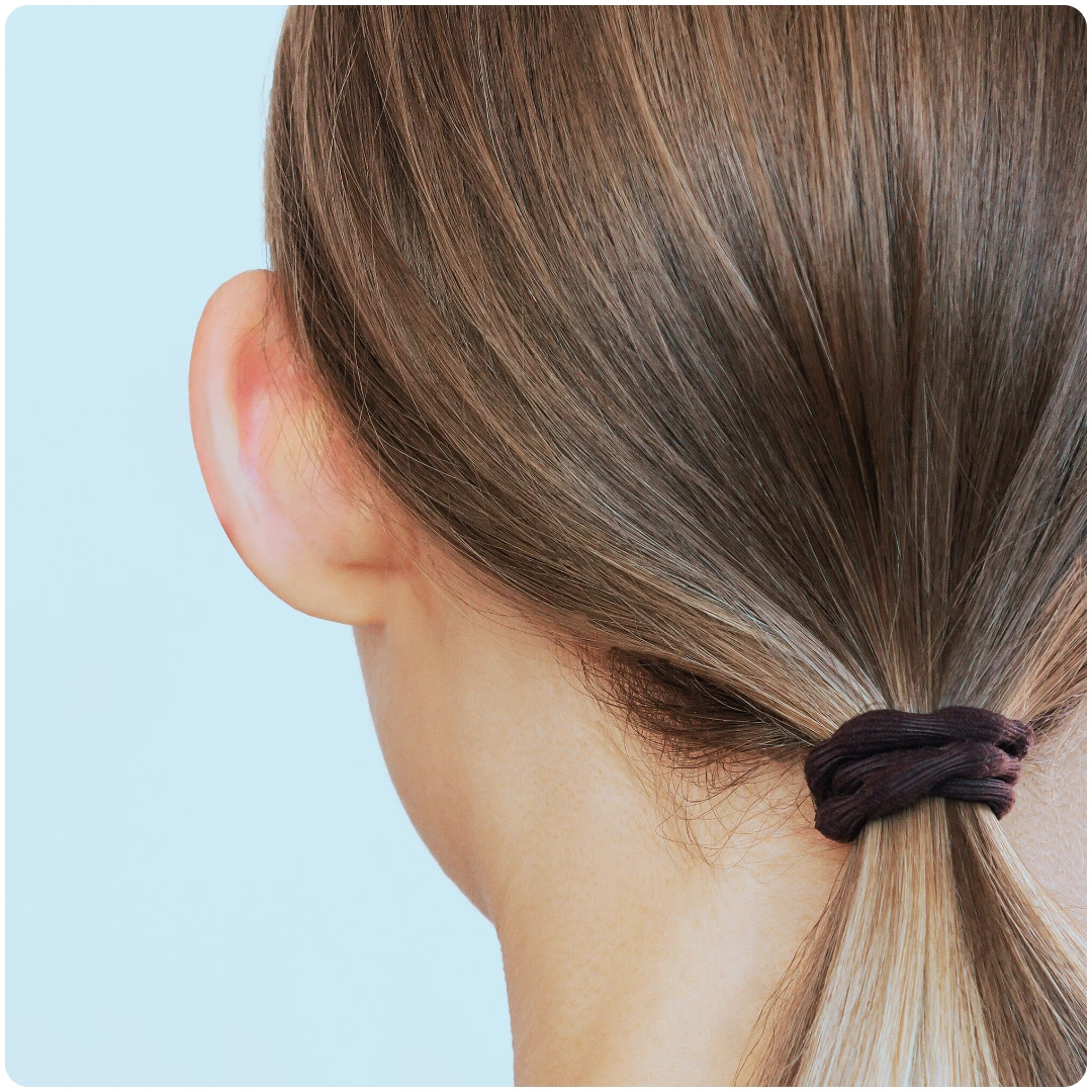 Cosmetic Bat Ear Correction 02