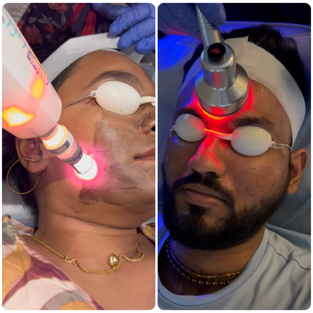 Fire and Ice Facial 01