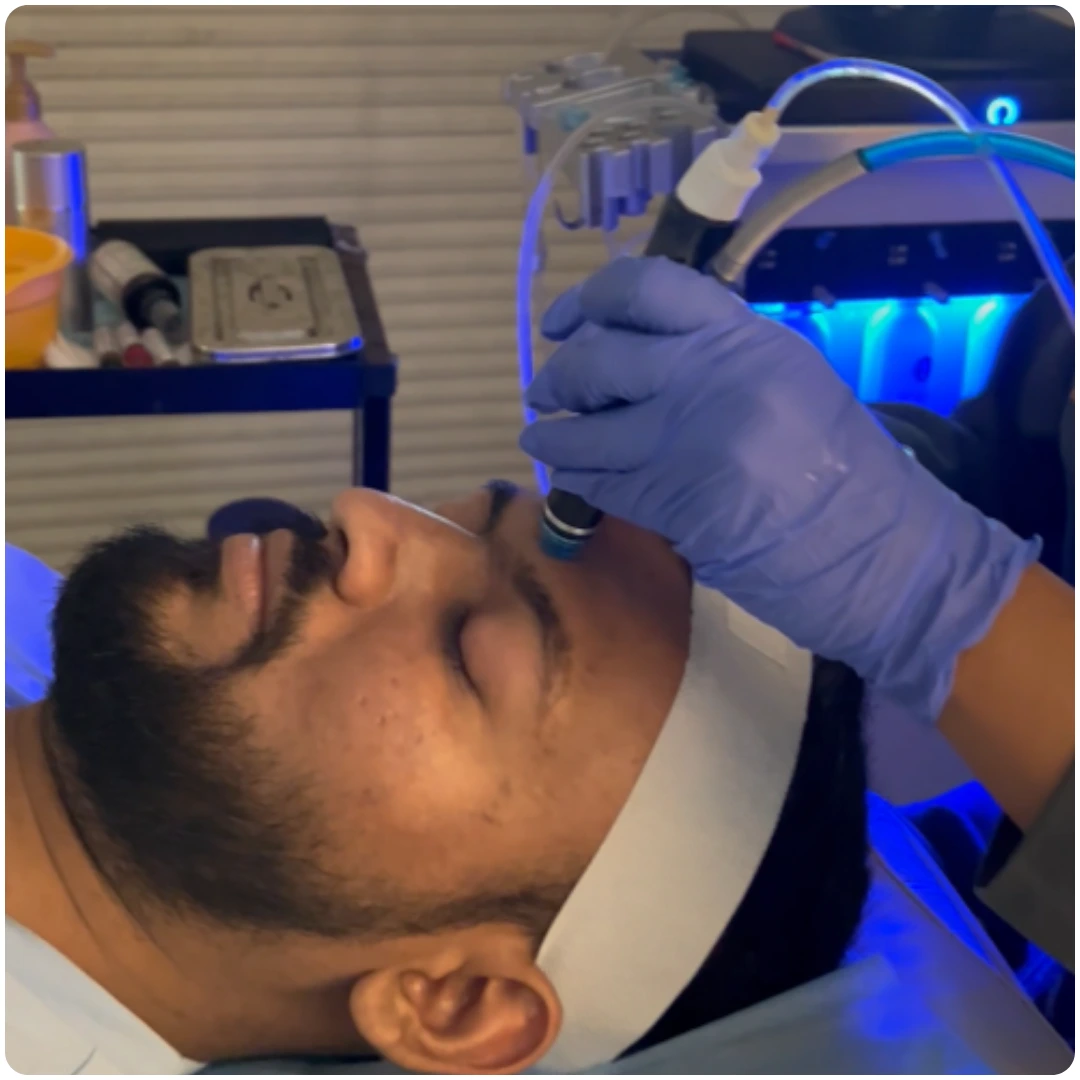 Fire and Ice Facial