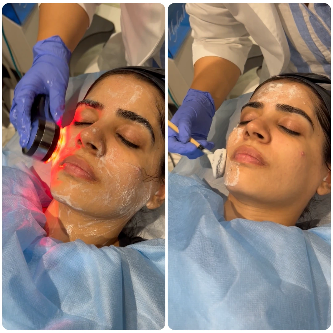 Foaming Enzyme Facial