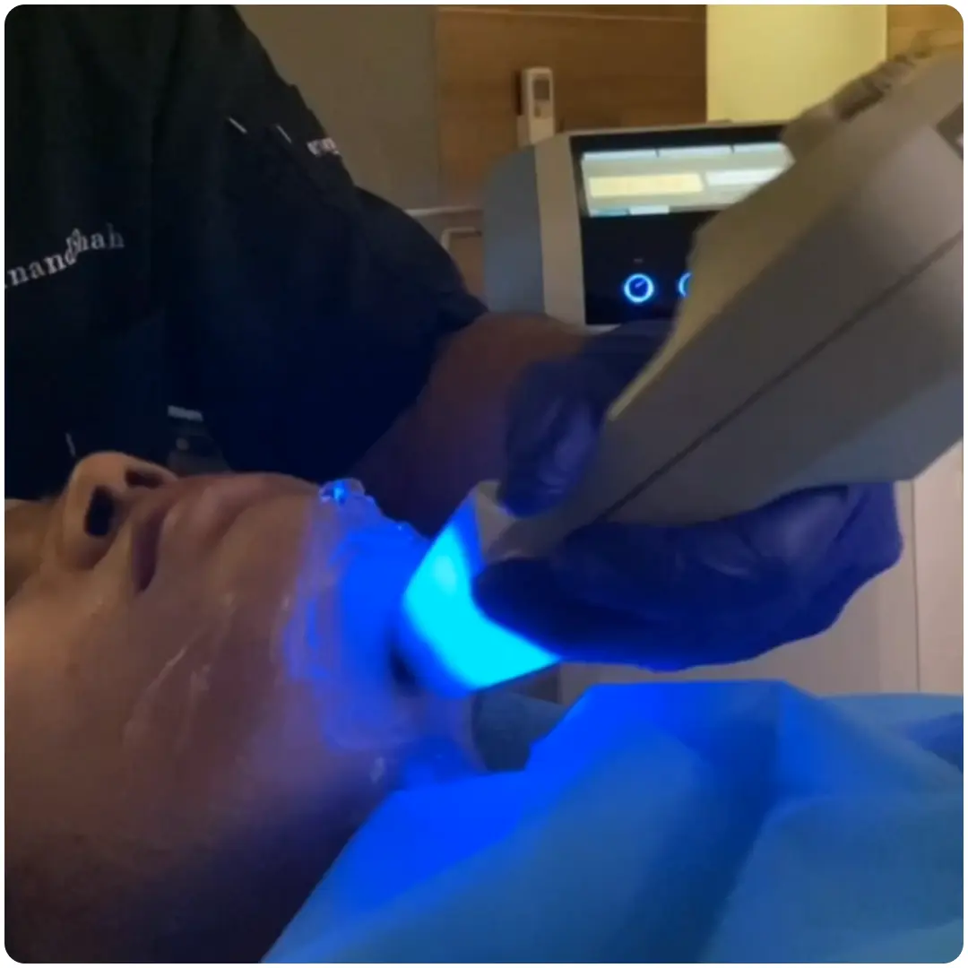Hot Stone Facelift