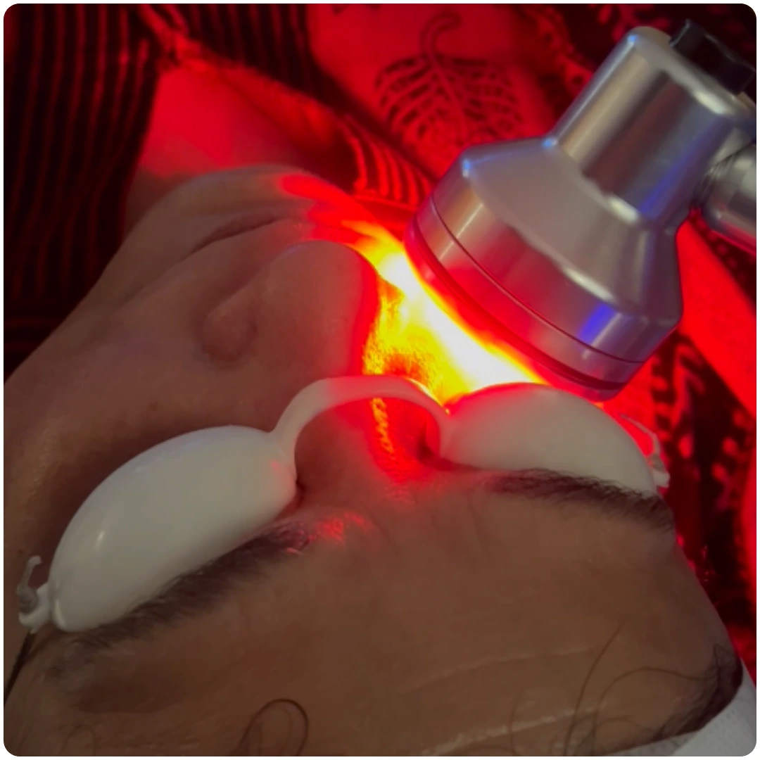 HydraFacial 02