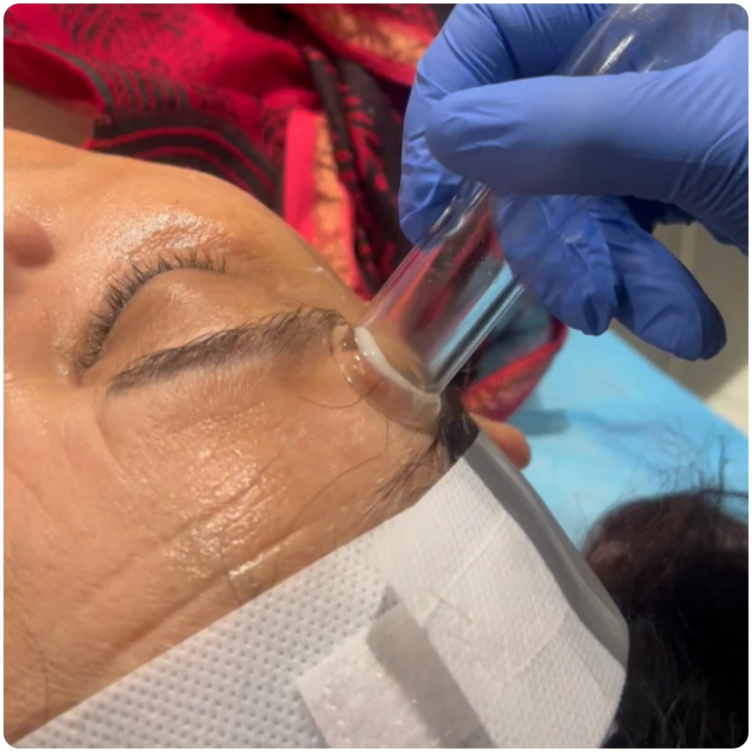 HydraFacial – Lymphatic Therapy