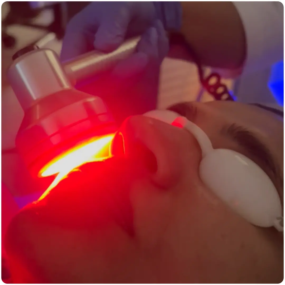 HydraFacial - Red LED Light Therapy