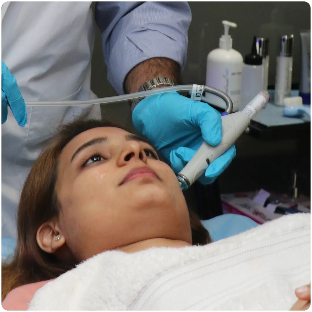 HydraFacial Treatment - Vortex Fusion
