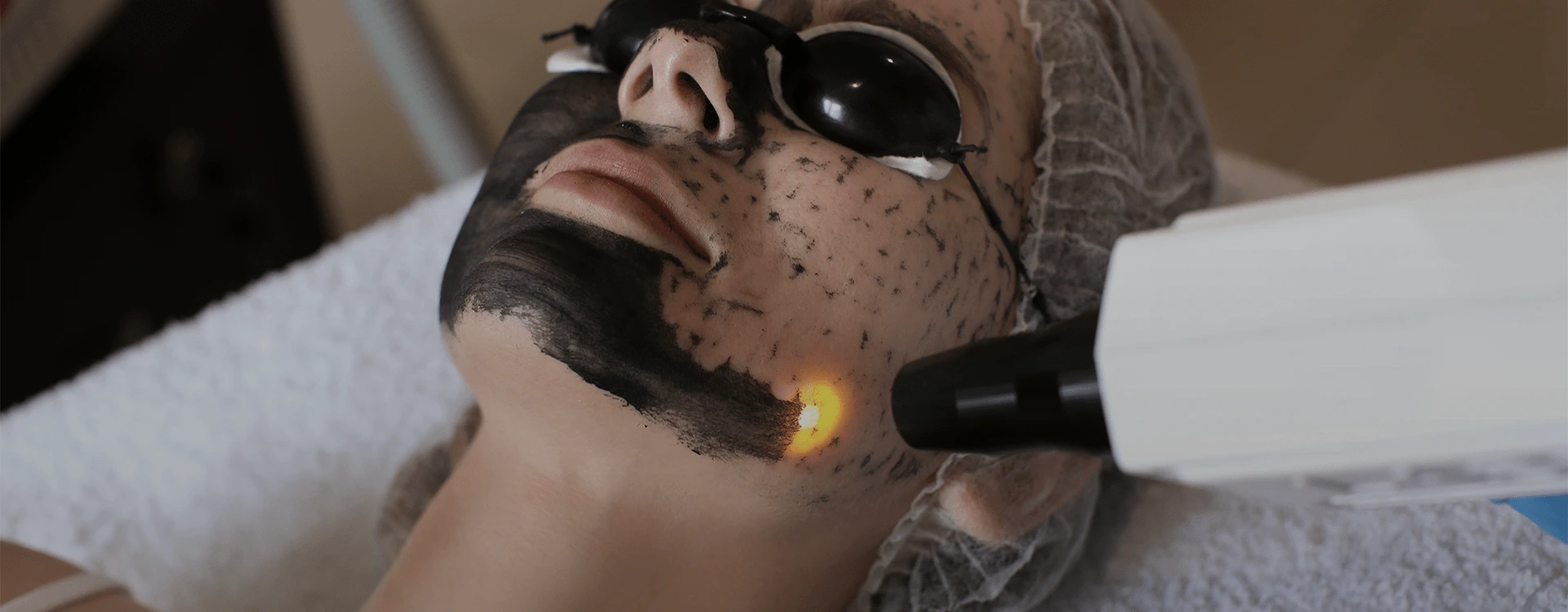 Laser Blackout Facial