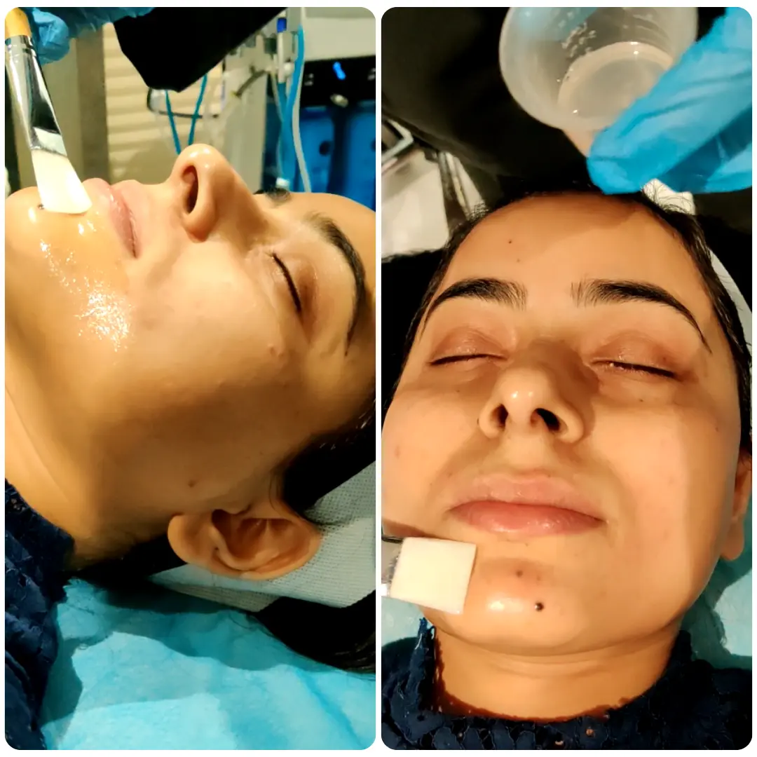 Musk Red Carpet Peel