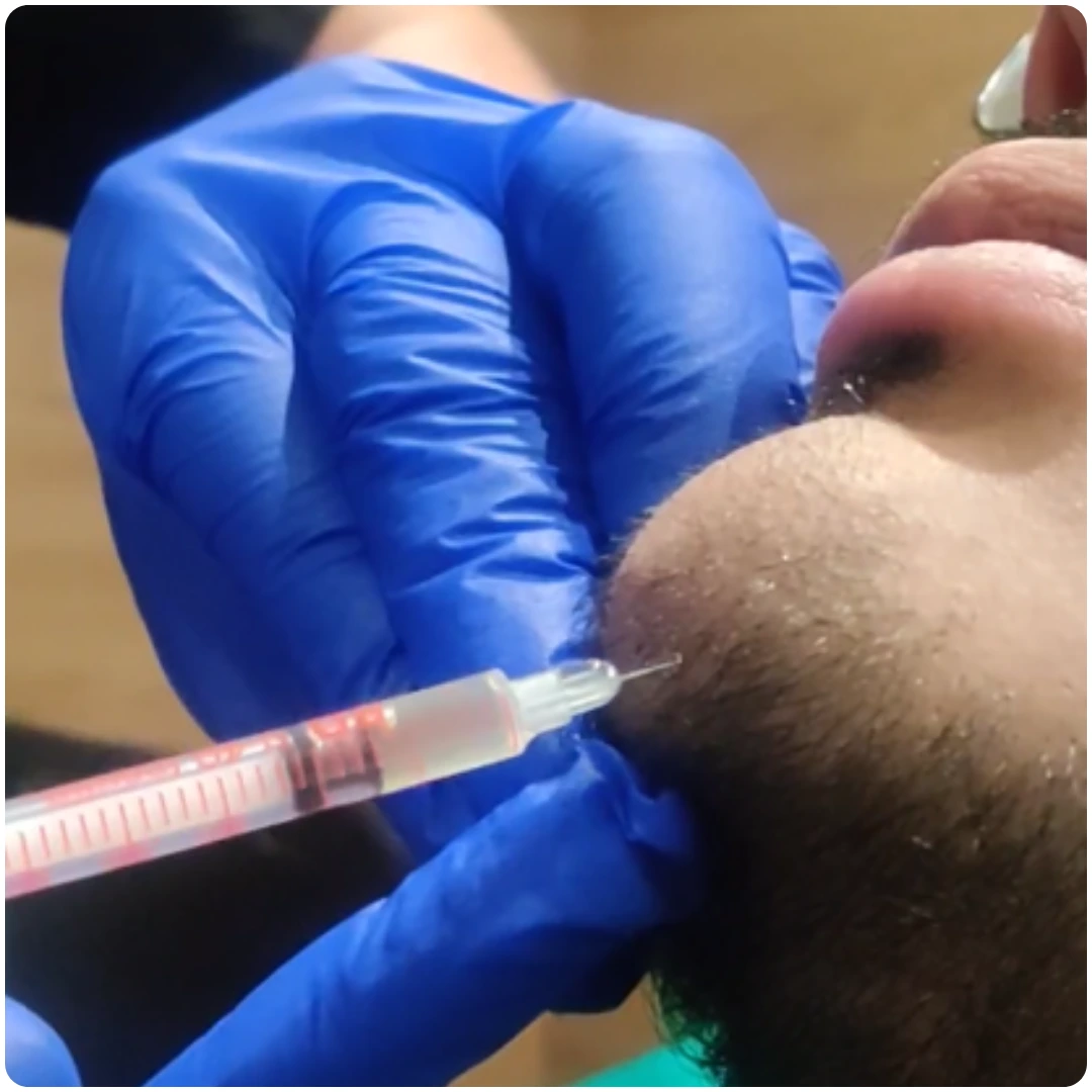 Orthognathic Surgery (Jaw Corrective Surgery)