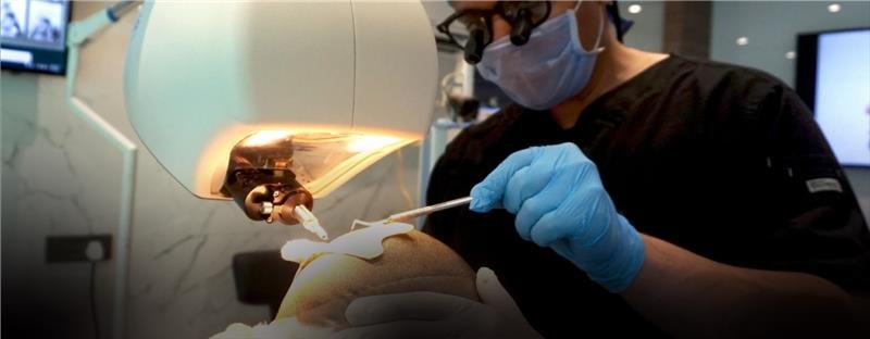 Revision Hair Transplant Surgery 3