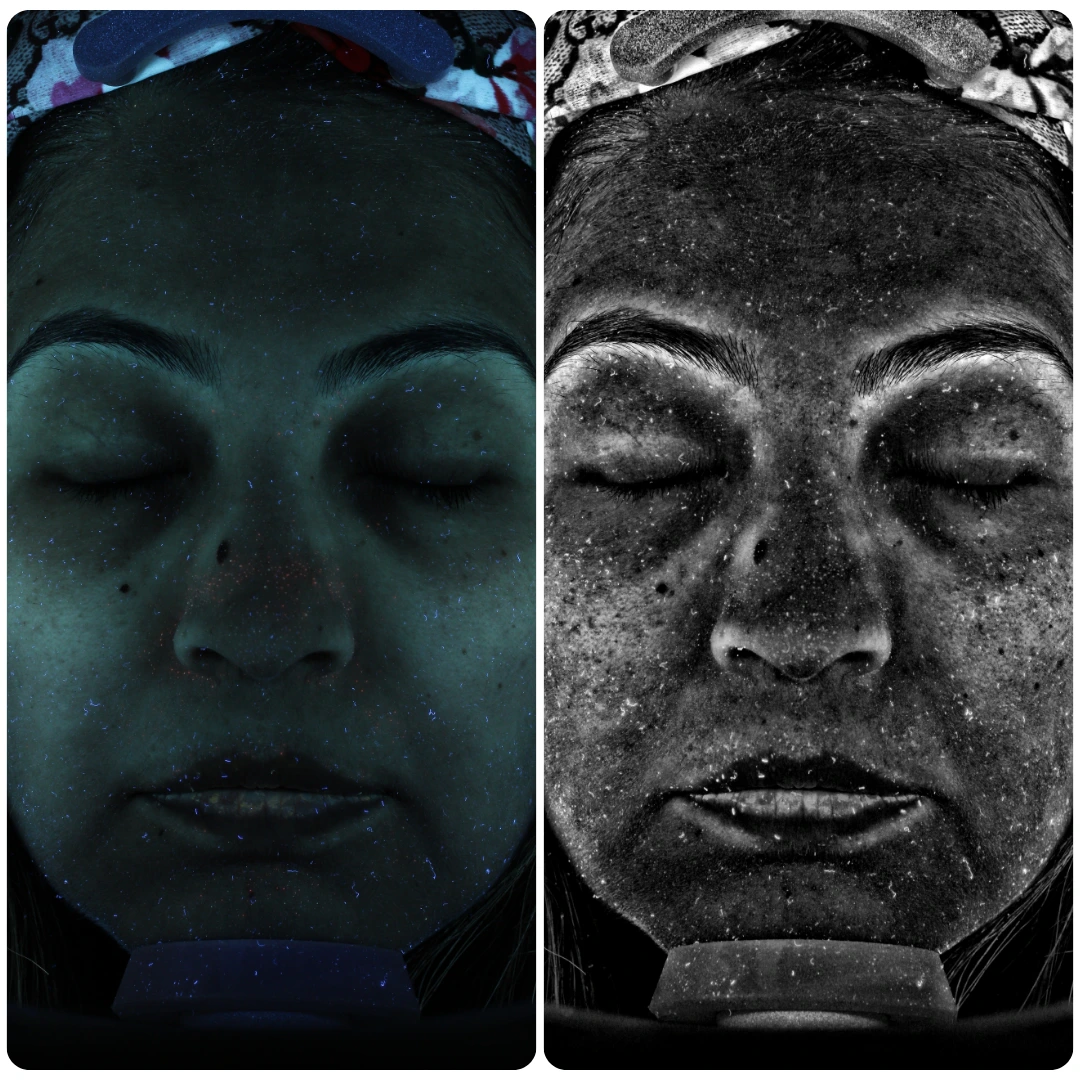 VISIA Face Scan 02