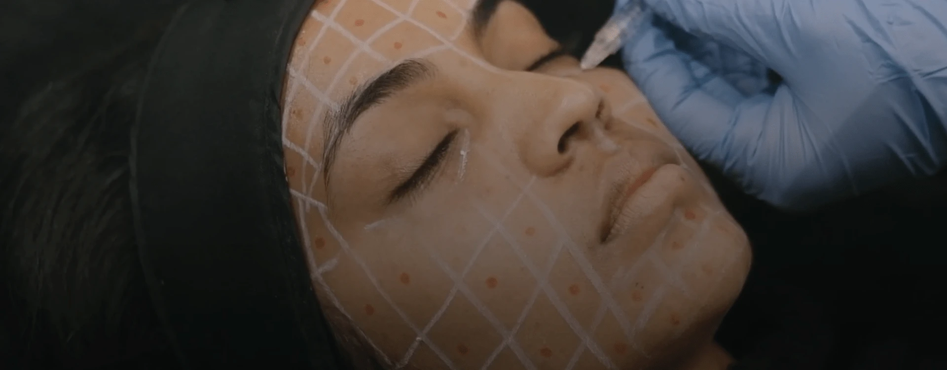 Volite Skin Hydration