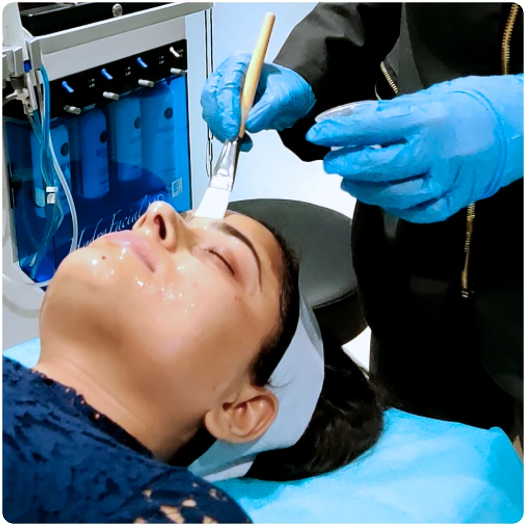 What To Expect from basic peel