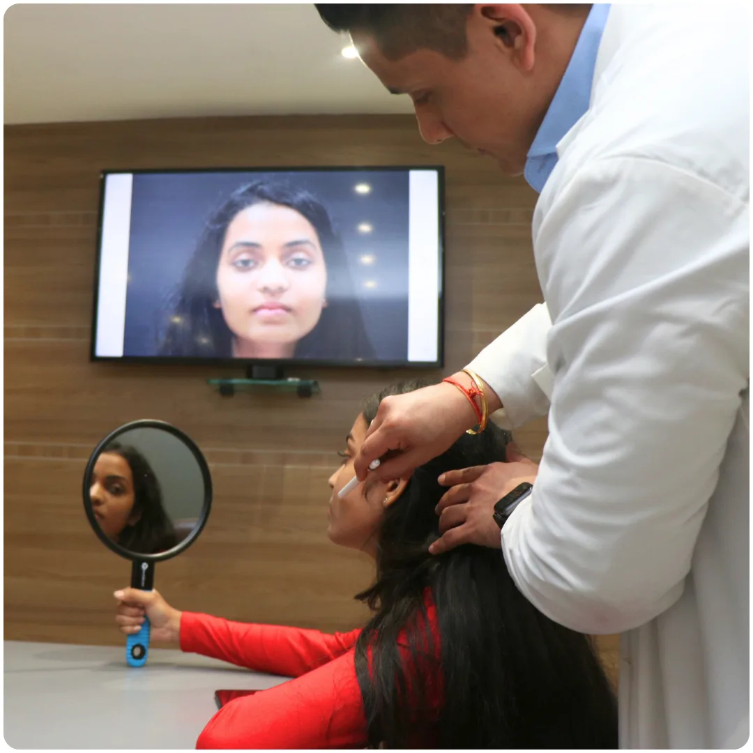 What is Face Trim (Buccal Fat Pad Excision)