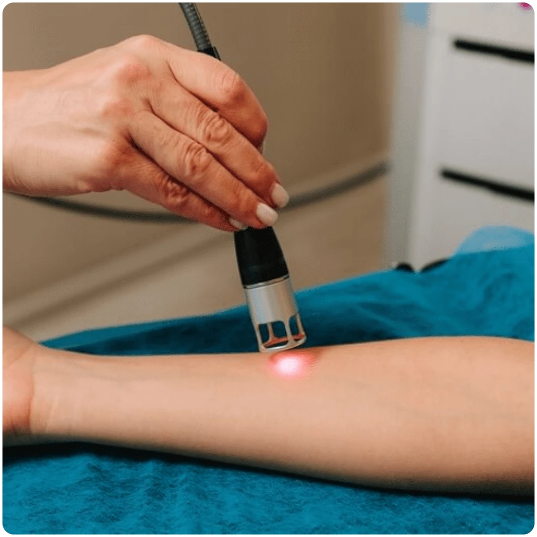 What is Flawless Hair Microbotox Therapy