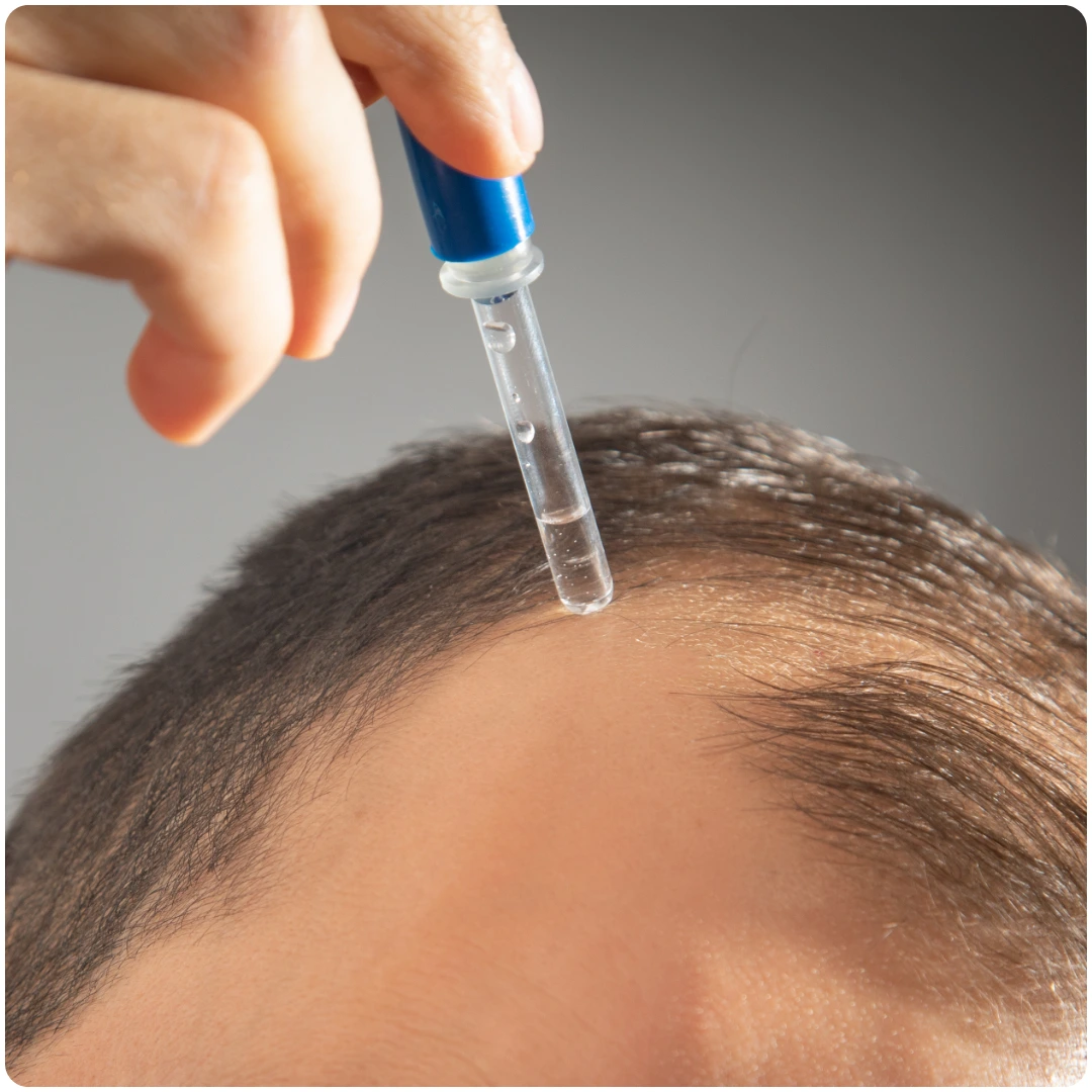 Finasteride