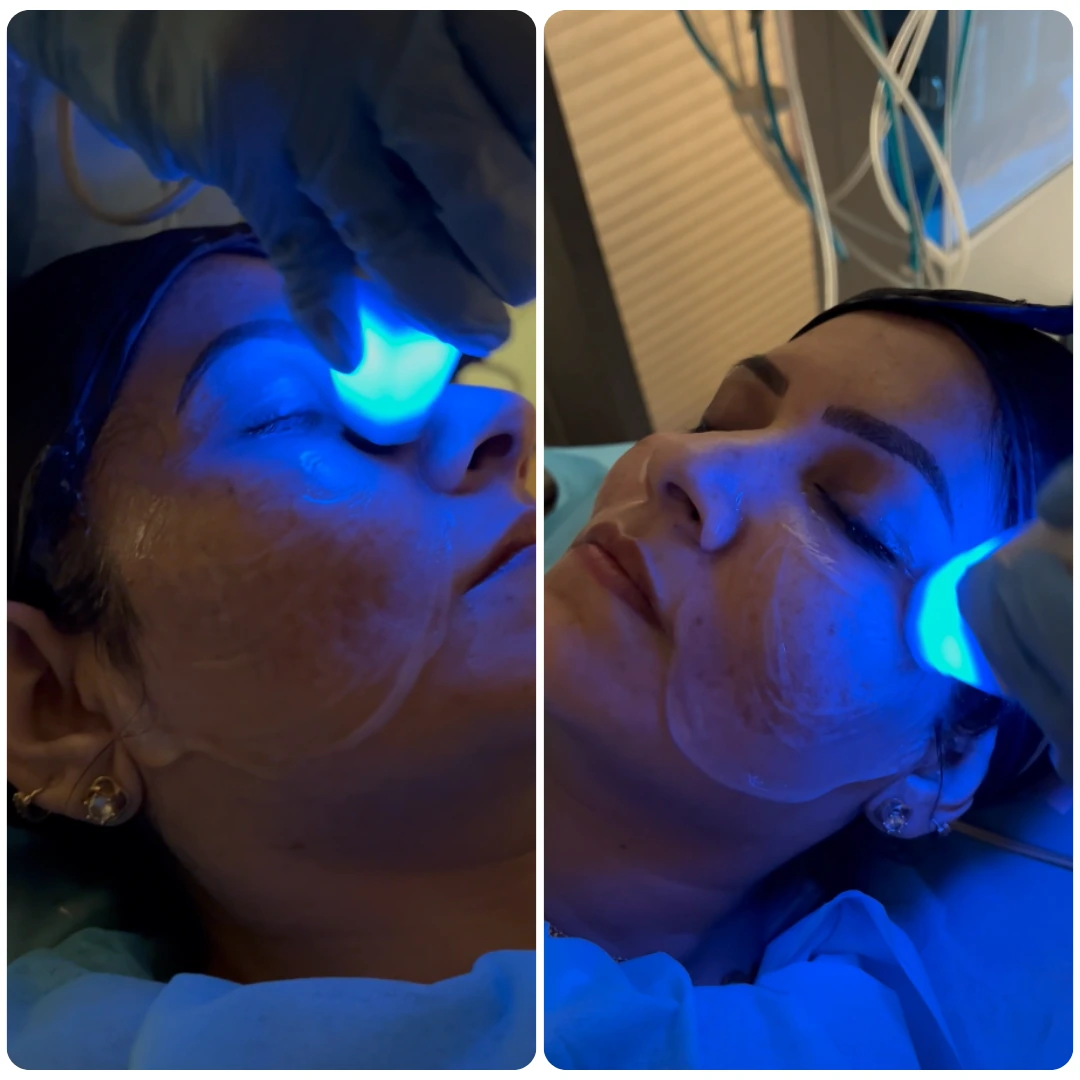 Hotstone Facial