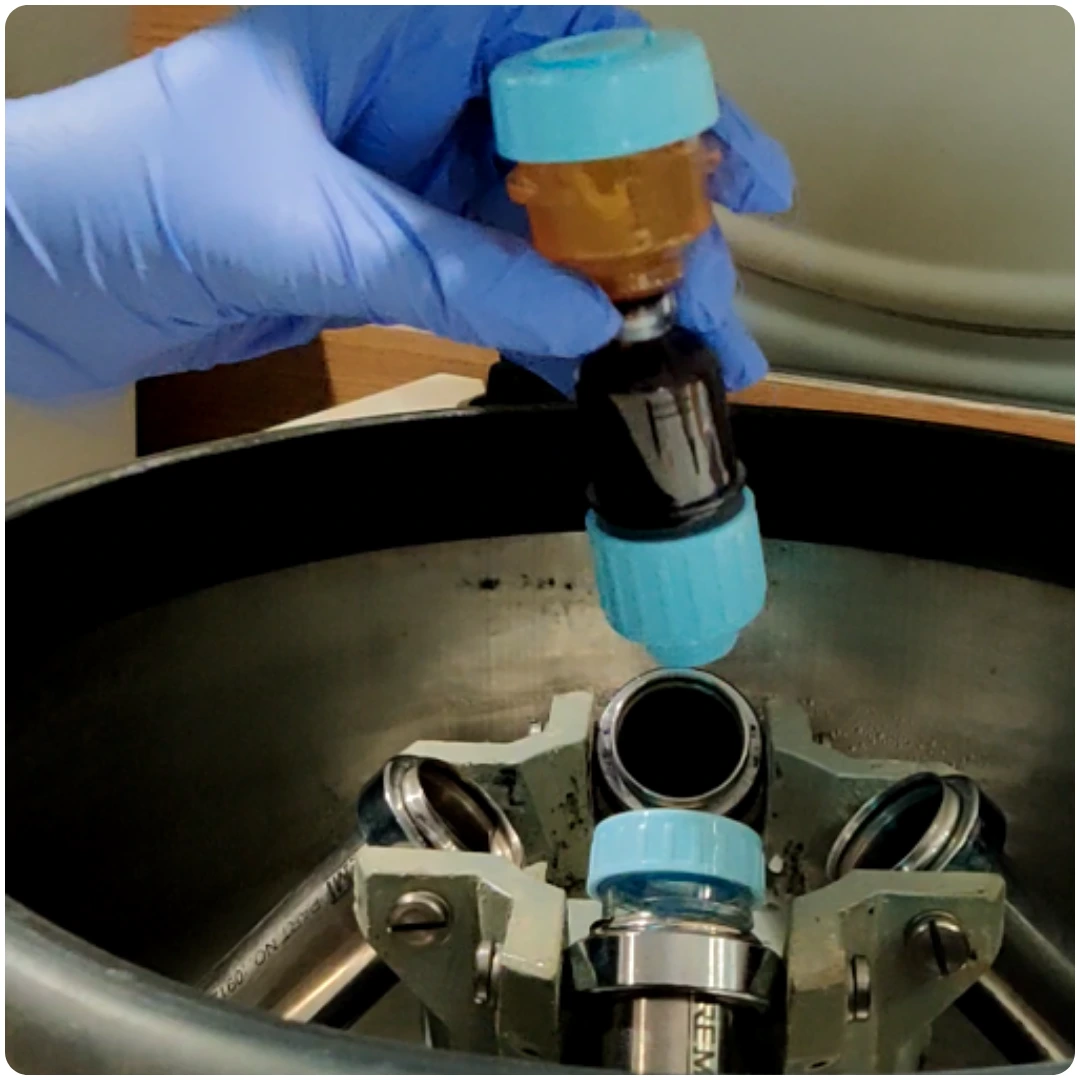 PRP Treatment
