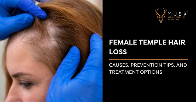 Female Temple Hair Loss: Causes, Prevention & Treatments